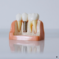 Maxillofacial trauma